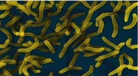 微生物菌劑好？好在哪里您知道嗎？